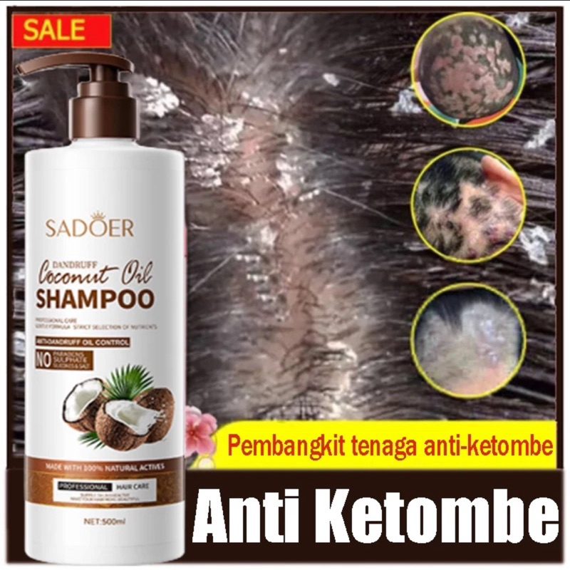 SAMPO ANTI KETOMBE PALING AMPUH HILANGKAN KETOMBE SAMPO minyak kelapa asli / Original sampo anti ket