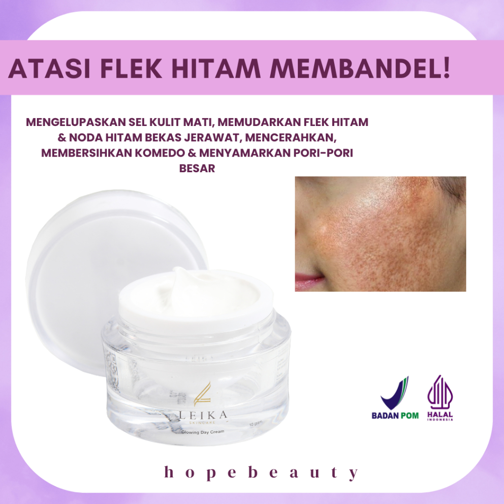 KRIM SIANG Penghilang Flek Hitam Di Wajah Ampuh Bpom Cream Flek Hitam Membandel Bpom Penghilang Flek