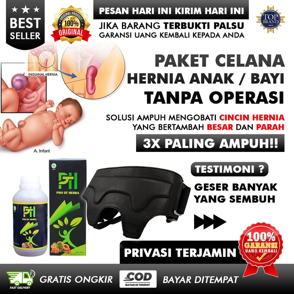 Celana Hernia Celana Hernia Bayi Balita Celana Dalam Hernia Bayi Celana Turun Berok Celana Usus Turu