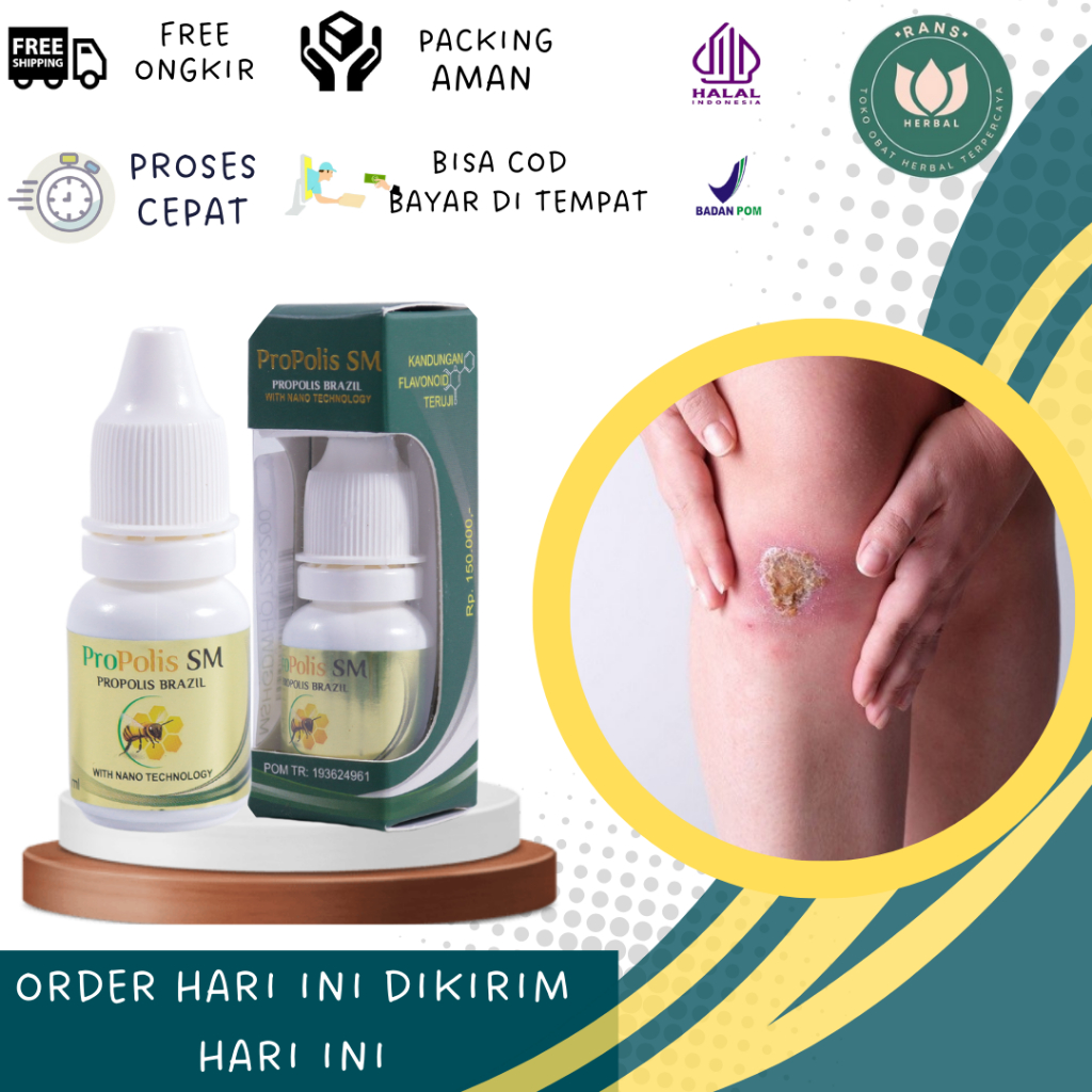 Obat Herbal Tetes Luka Bernanah Obat Luka Borok Bernanah Obat Salep Infeksi Luka Bernanah Obat Oles 