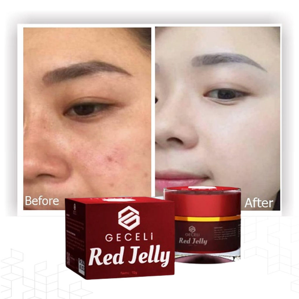 Red Jelly Geceli Basic Pack 2 in 1 - Glowing Night Cream, Glowing Day Cream Original Cream Milia Pen