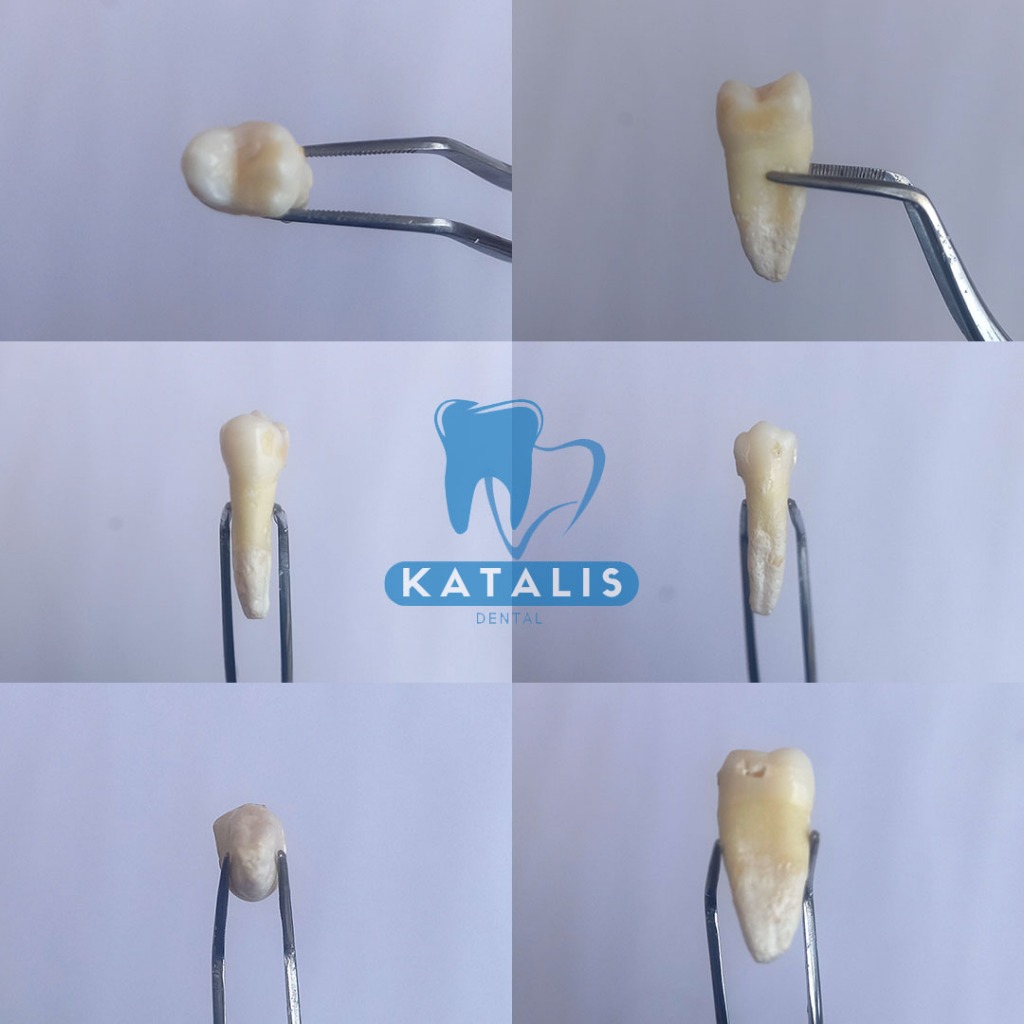 (PREMOLAR) Gigi Permanen Asli untuk Pratikum RA & RB - Gigi Premolar