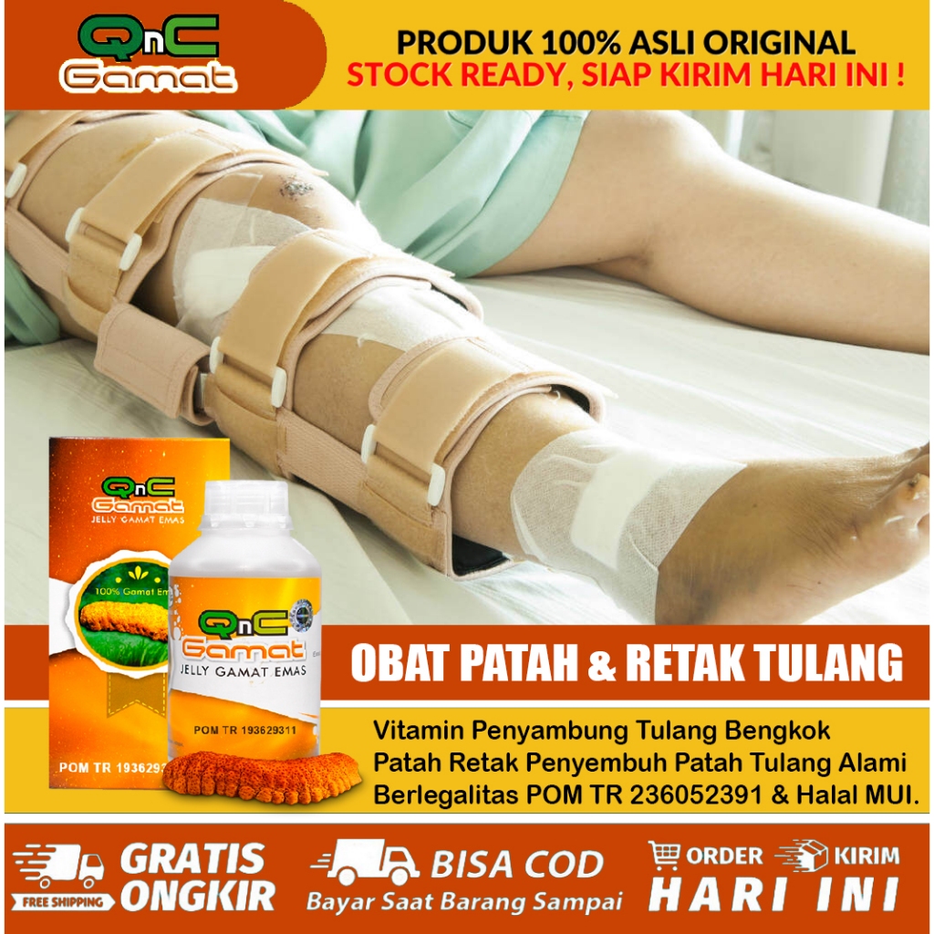 Obat Patah Tulang Herbal, Tulang Retak, Tulang Patah, Tulang, Bengkok, Tulang Bengkak, Obat Penyembu
