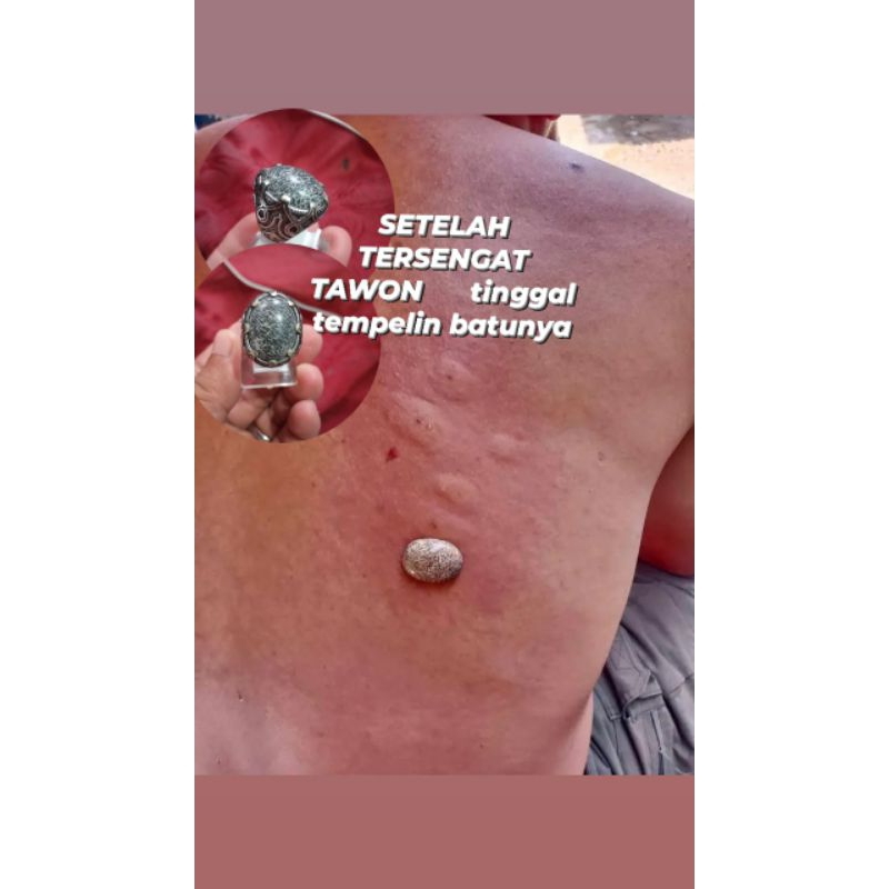 Batu Anti Wisa Cirebon