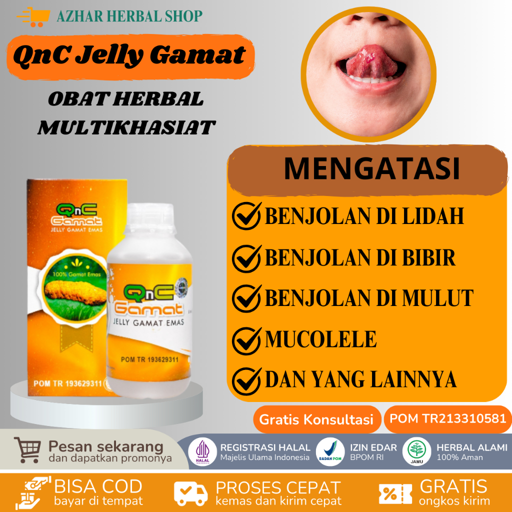 QnC Jelly Gamat Obat Benjolan Di Lidah, Benjolan di Bibir Mulut, Penghilang Benjolan Lidah