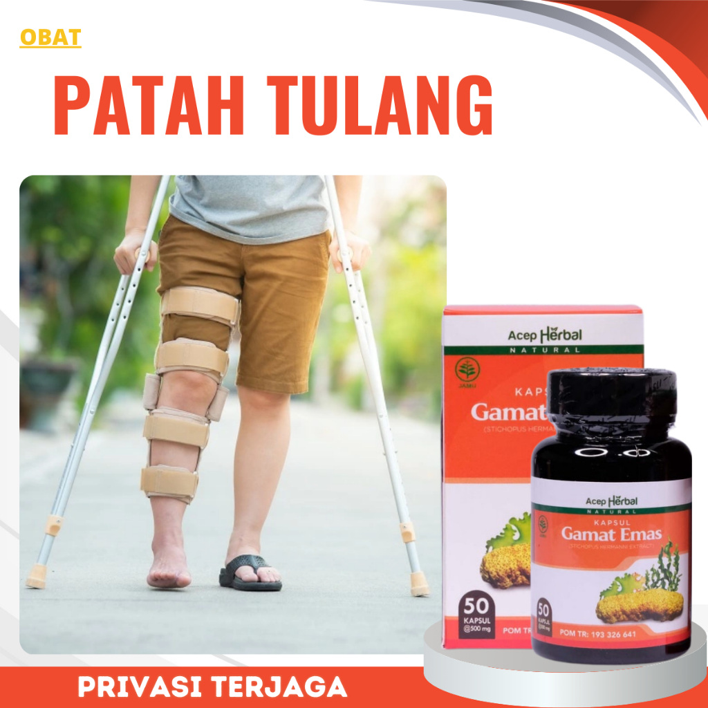 Obat Patah Tulang, Obat Tulang Retak, Pereda Nyeri patah Tulang, Obat Tulang Keropos, Obat Pemulihan