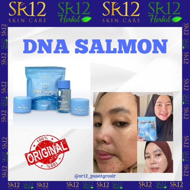 SR12 DNA SALMON SERIES || DNA SALMON SATUAN