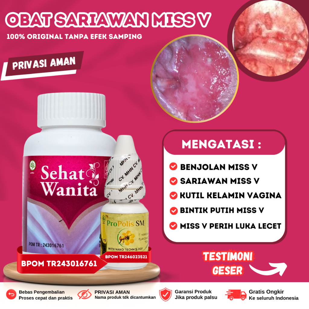 Obat Sariawan Miss v, Obat miss v perih da gatal Vagina , Infeksi Jamur pada miss v lecet dan sakit