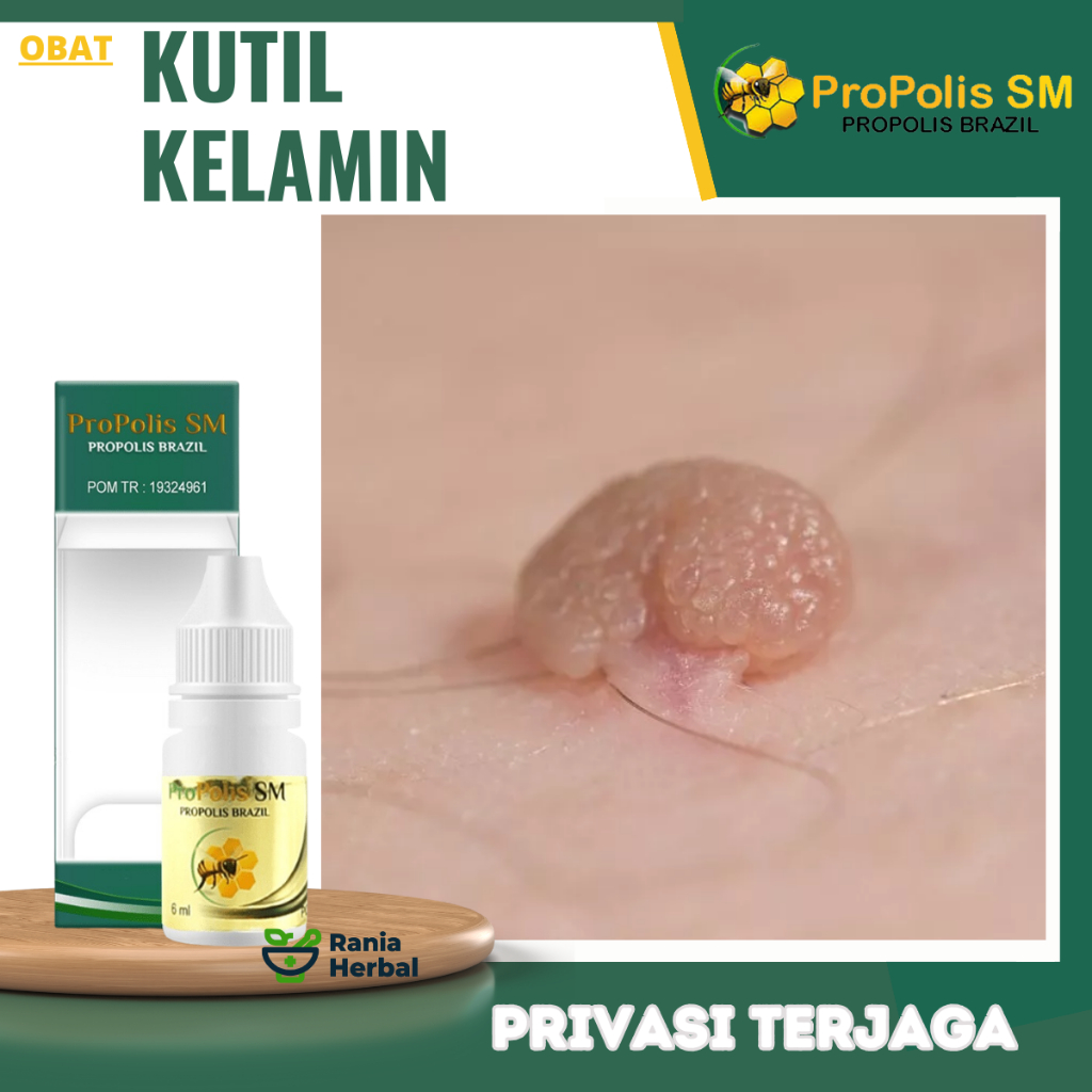 Obat Kutil Kelamin Pria dan Wanita, Obat Perontok Kutil Kelamin Pria / Wanita, Salep Kutil Kelamin, 