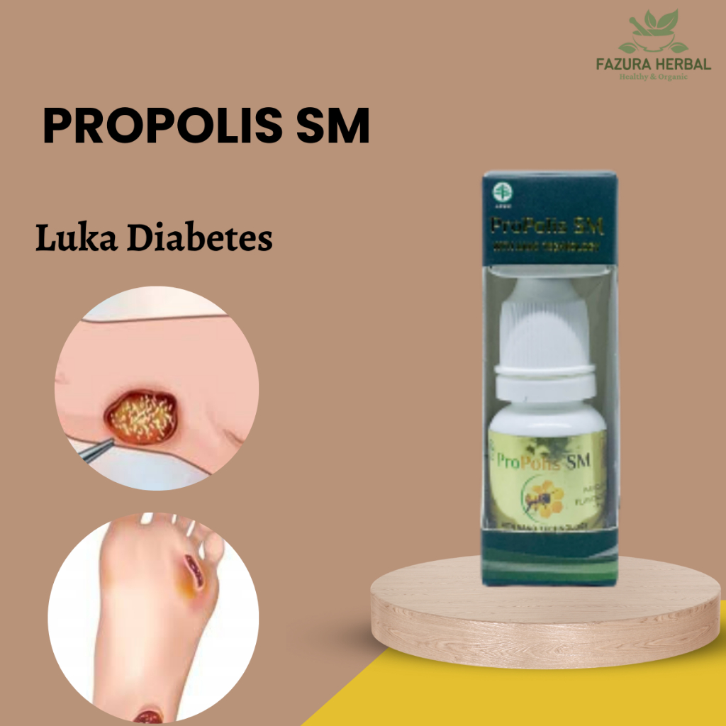 Obat Luka Diabetes, Pengering Luka Diabetes, Luka Diabetes Bernanah, Luka Diabetes Berdarah, Luka Di