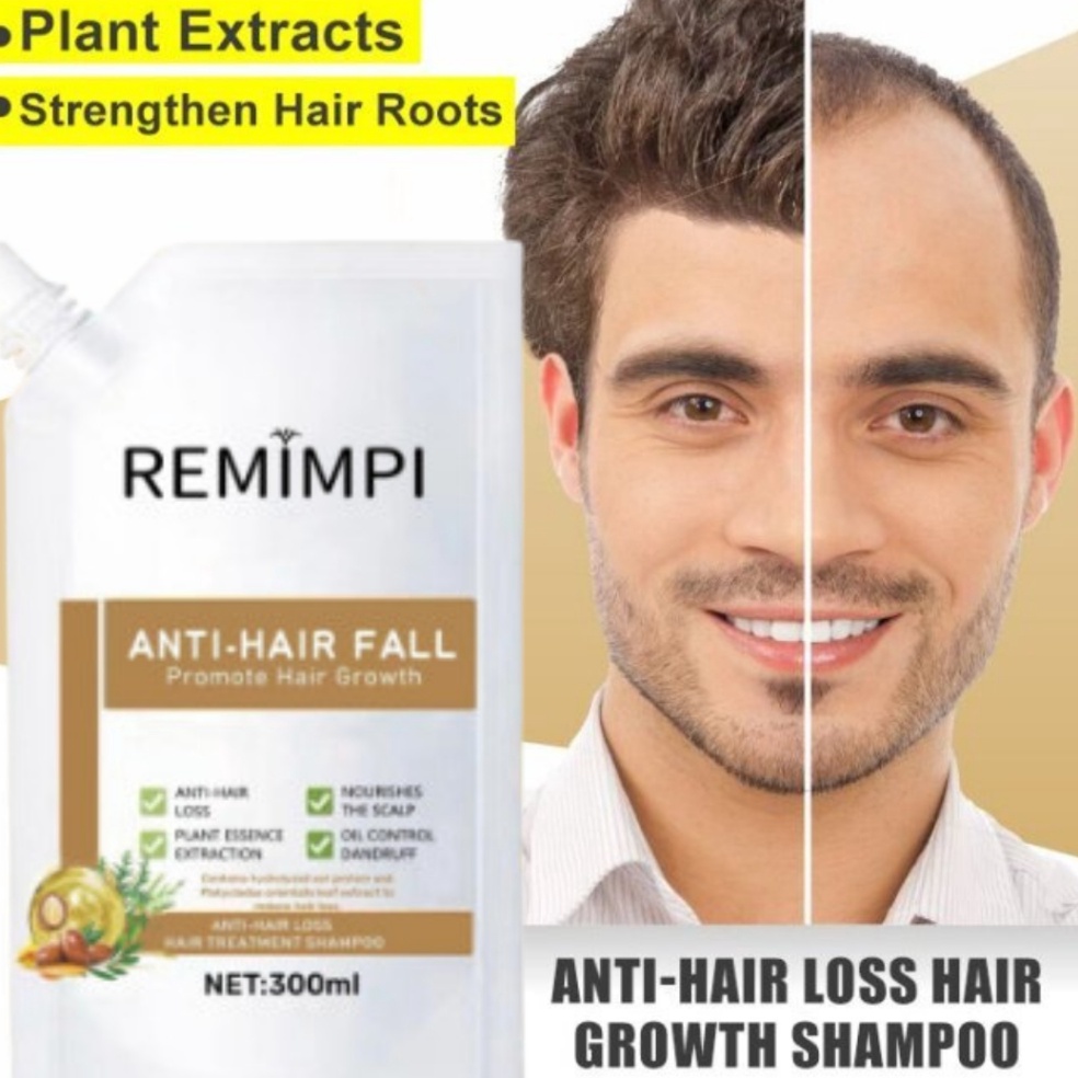 KODE I6H Remimpi Official  Shampoo Remimpi Penumbuh Rambut Botak dan Tipis