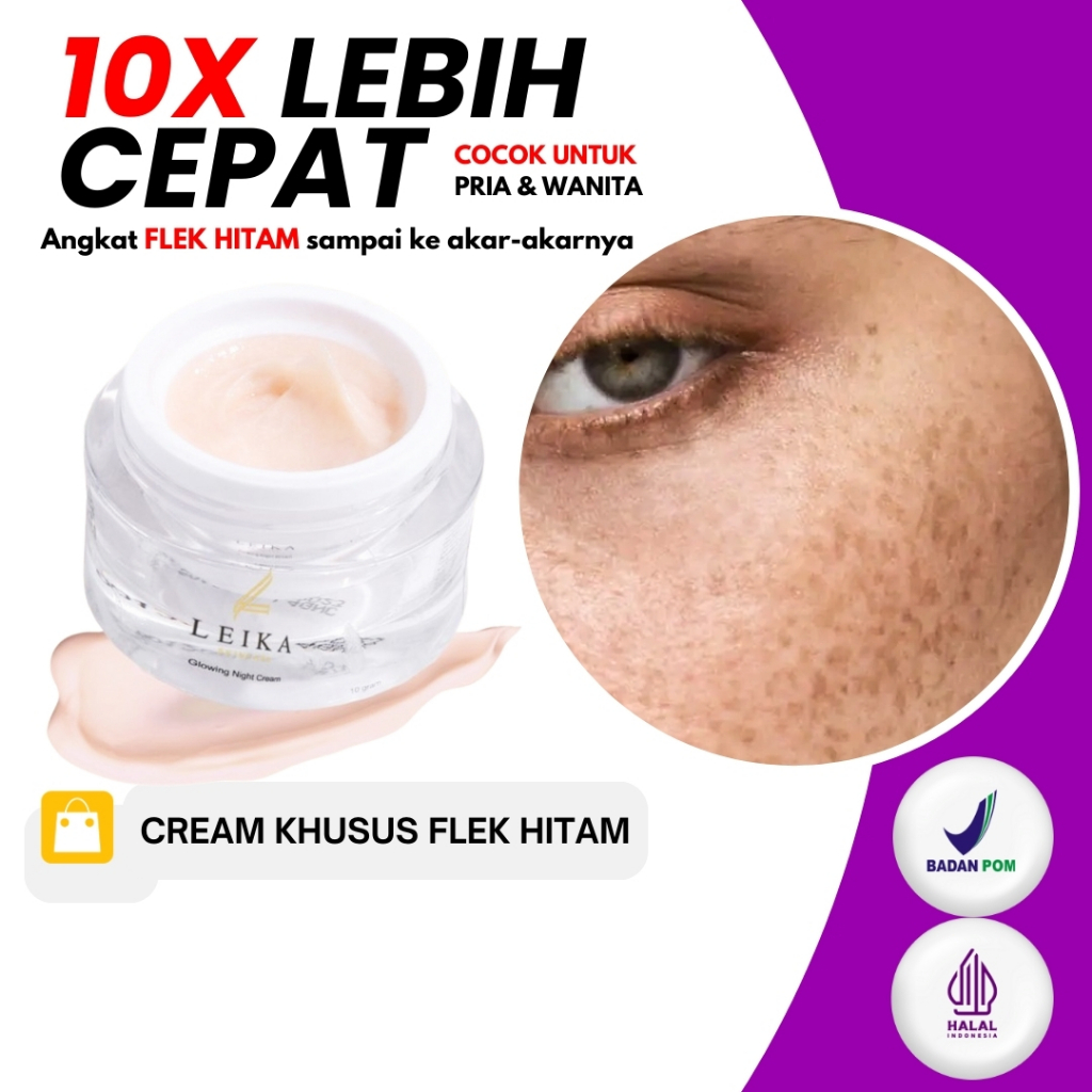 Obat Melasma Bercak Gelap Wajah Berwarna Cokelat Di Leher Bahu Lengan Bagian Bawah Skin Tags Milia B