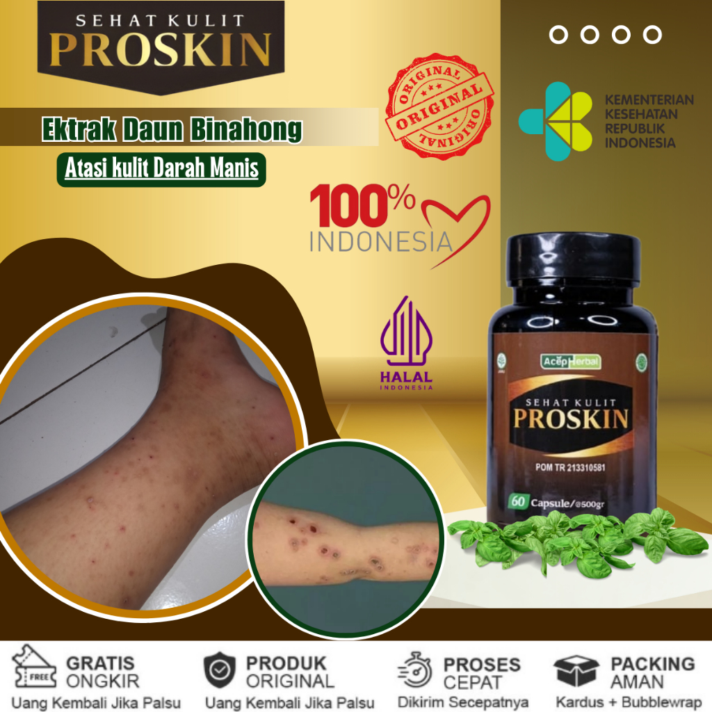 Obat Darah Manis, Obat Penghilang Darah Manis, Obat Prurigo, Obat Bintik - Bintik di Kaki, Obat Kore