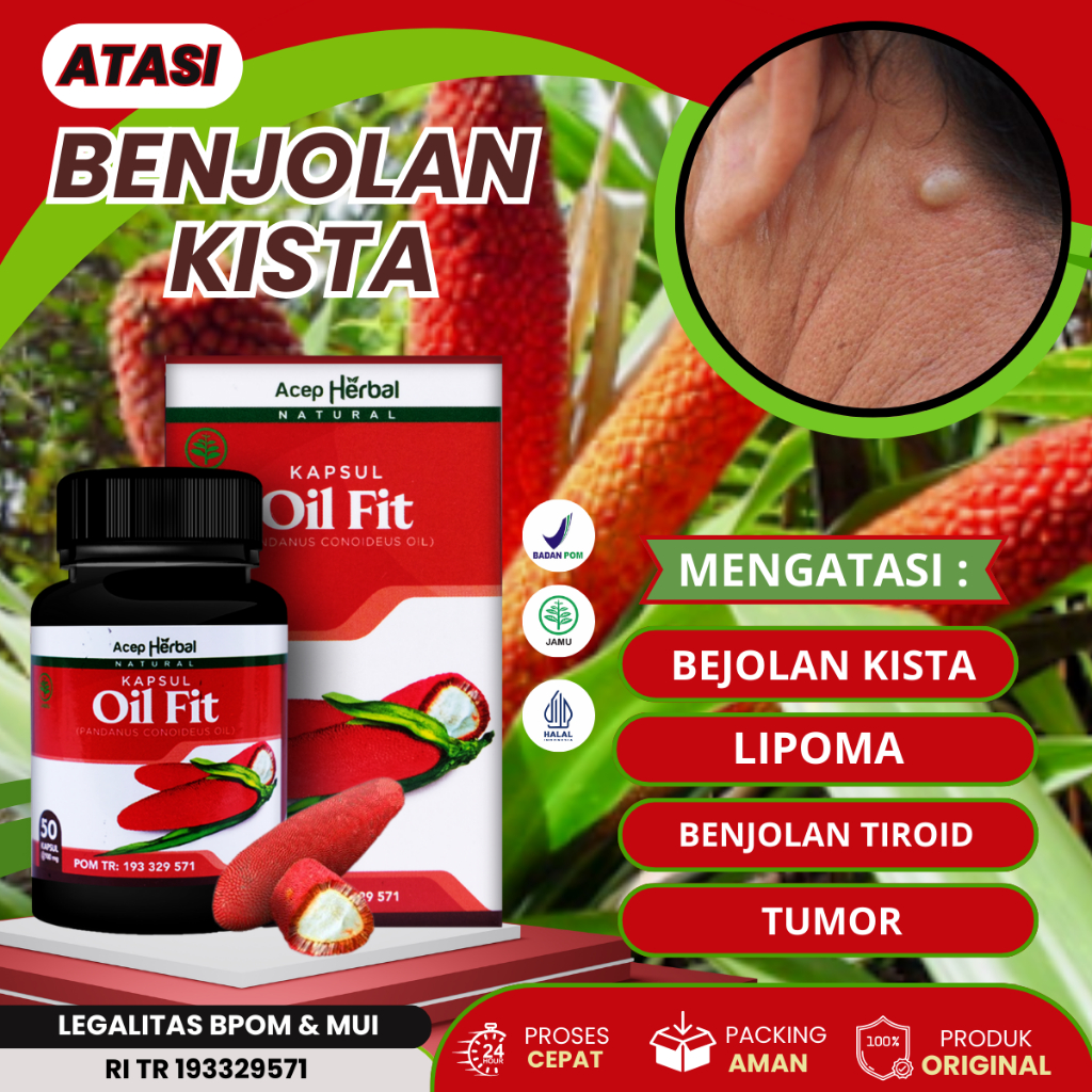 Oil fit - Obat Benjolan kista, Pengempis Benjolan Lipoma, Bejolan Tiroid, Benjolan Kelenjar Getah Be