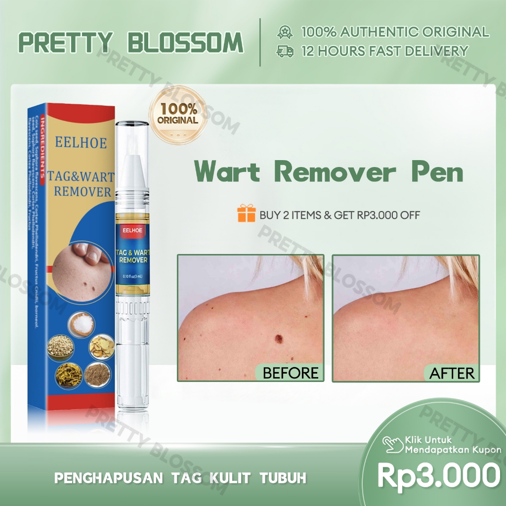 EELHOE Wart Remove Pen 1pcs Pembersih Kutil Krim Penghilang Tahi Lalat Kutil Ampuh Wart Remove Cream
