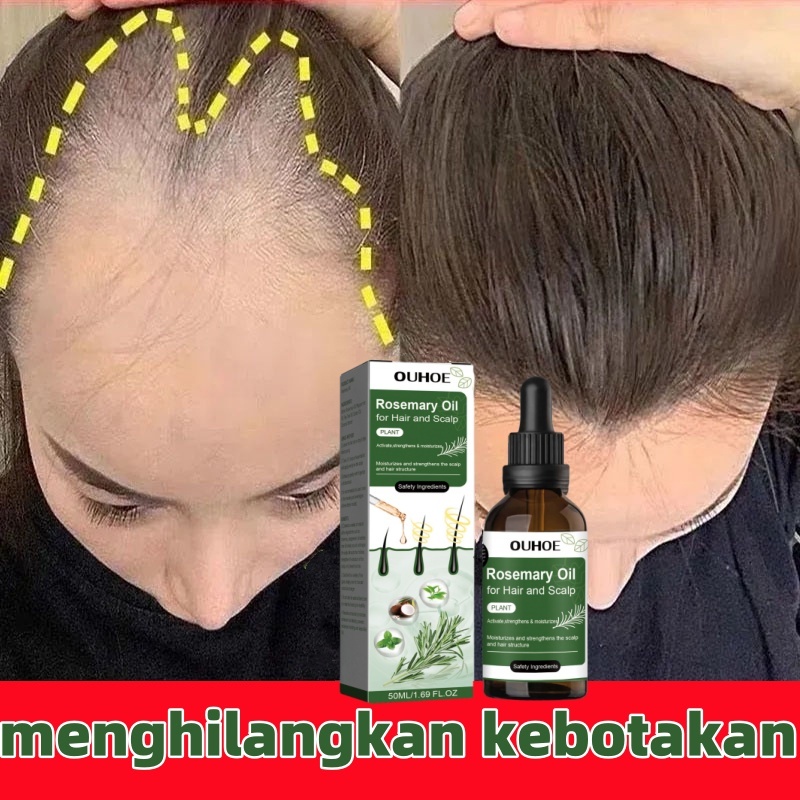 rosemary oil rambut  penumbuh rambut botak perawatan rambut rontok minyak rosemary untuk rambut obat