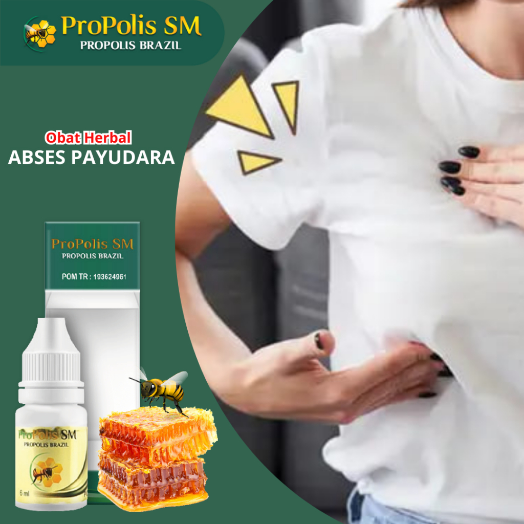 Obat Abses Payudara Penghancur Benjolan di Payudara Nyeri Payudara Infeksi Tumor Payudara