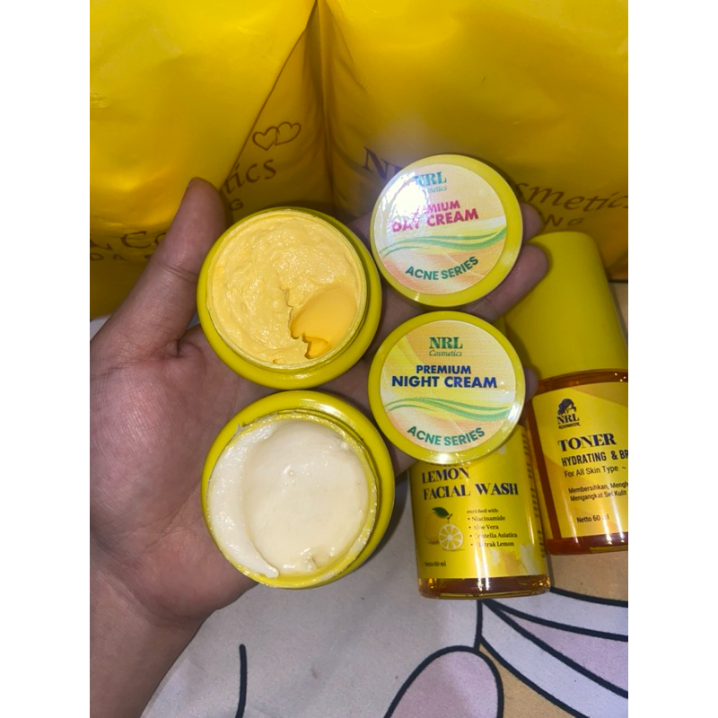 ECER CREAM NRL FLEK, ACNE DAN FLOWING