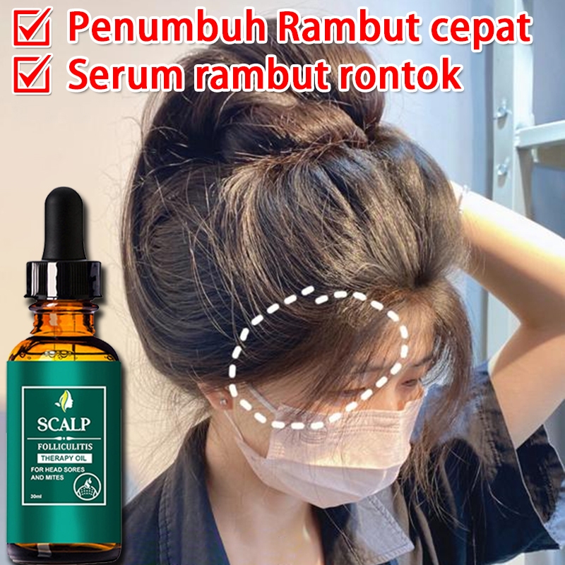Minyak Esensial Perawatan Rambut Rontok Rambut Rusak Serum Essential Oil Cepat Hair Tonic Penumbuh R