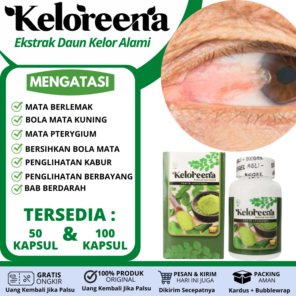 Obat Untuk Didalam Mata Hitam Ada Cairan Putih, Bintik Putih Pada Kornea Mata, Obat selaput mata put
