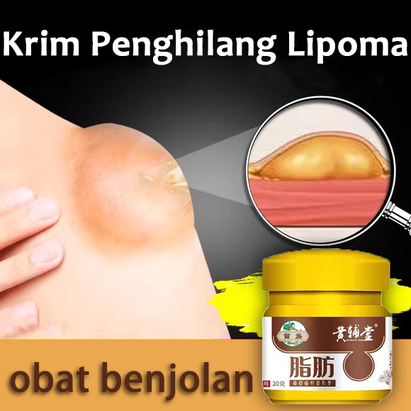 lipoma cream obat benjolan lipoma cream original salep lipoma salep benjolan salep lipoma paling amp