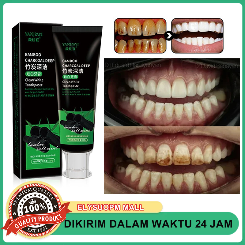Ampuh bamboo charcoal toothpaste membersihkan karang gigi memutihkan kuning gigi pasta odol pemutih 