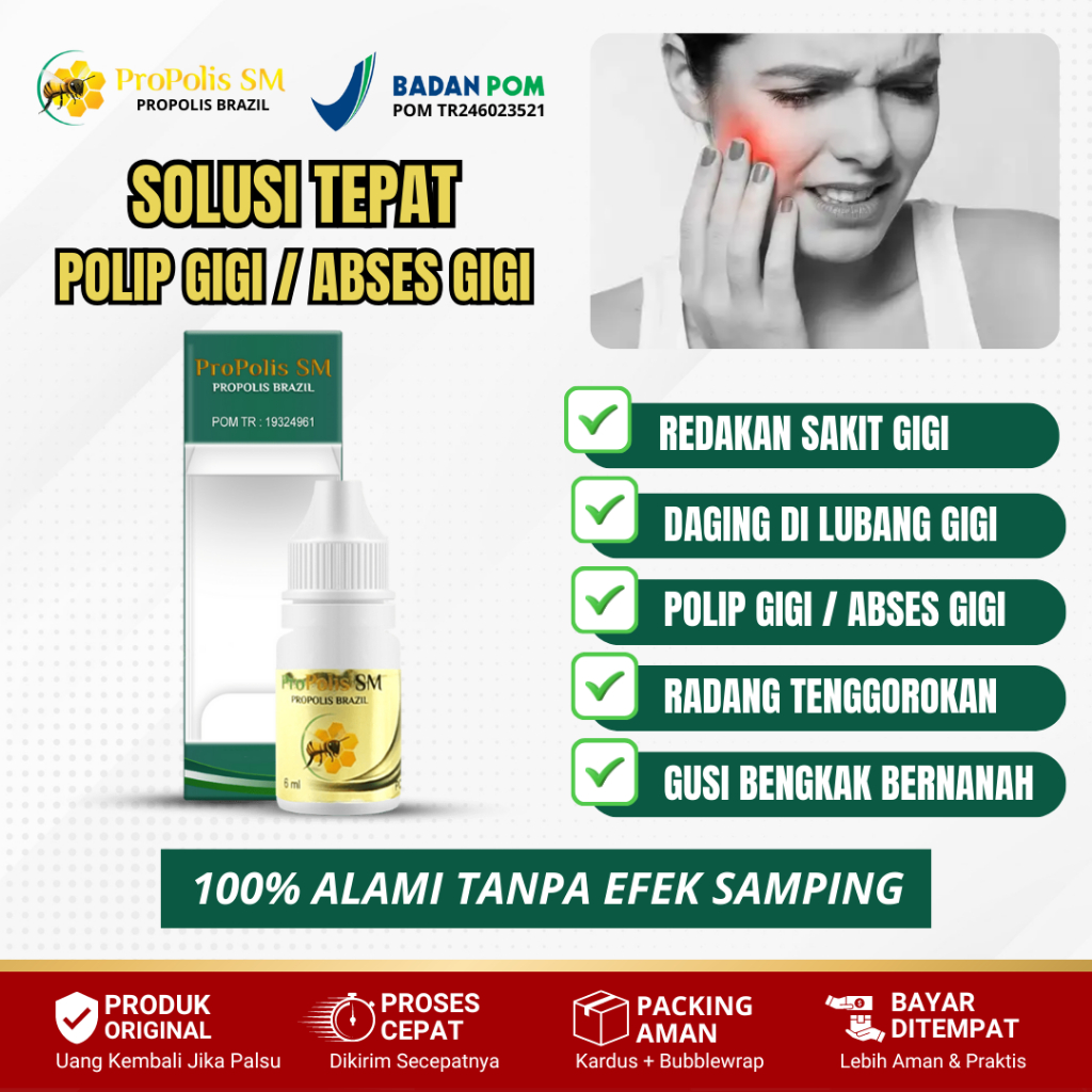 Obat Polip Gigi, Polip Gusi, Abses Gigi, Obat Daging Tumbuh Di Gigi Berlubang - Propolis SM