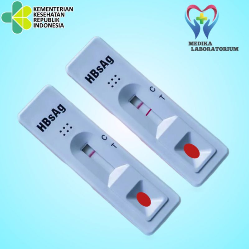 Tes HBsAg Satuan