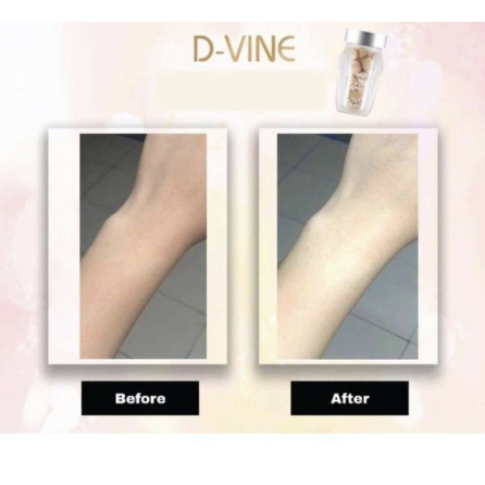 PROMO  D VINE Original 60 Tablet kolagen Kecantikan