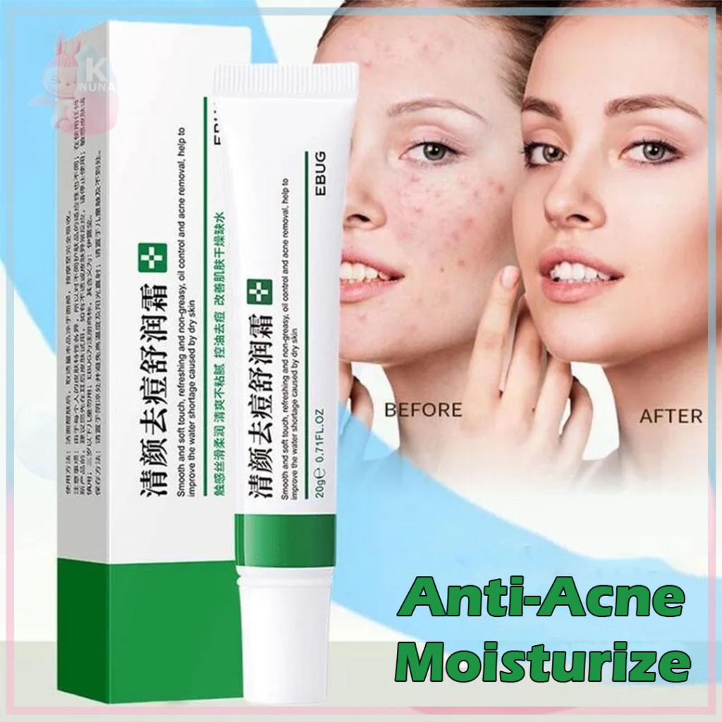 EBUG Anti Acne Moisturize Cream Krim Jerawat Pelembab Wajah Jerawatan Mengencangkan - VP030 Hijau