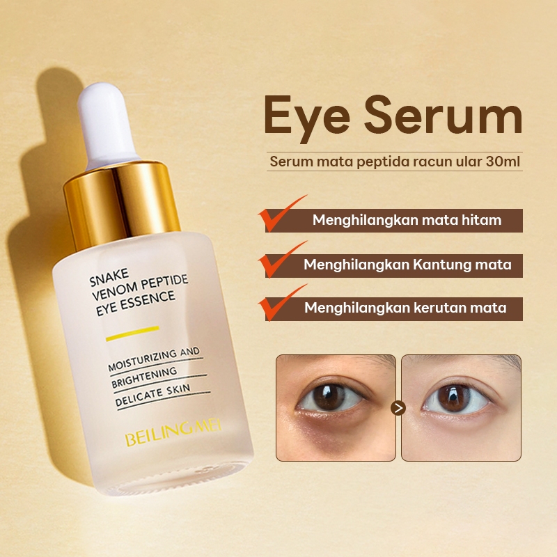 Eye Serum - Eye Treatment Eye Cream untuk 30ML Efektif menghilangkan mata panda Mata hitam Serum Eye