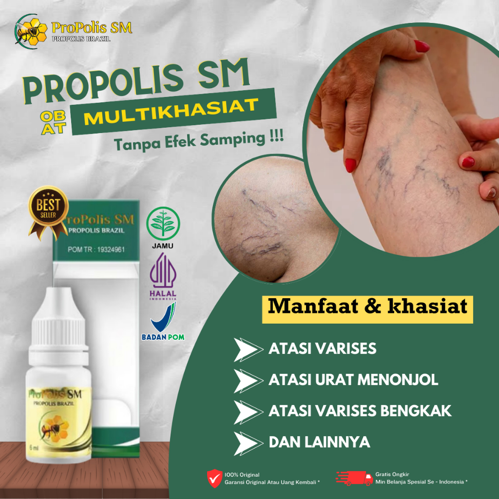Obat Varises, Obat Penghilang Varises Di Betis, Obat Mengatasi Urat, Obat Urat Menggumpal, Obat Urat
