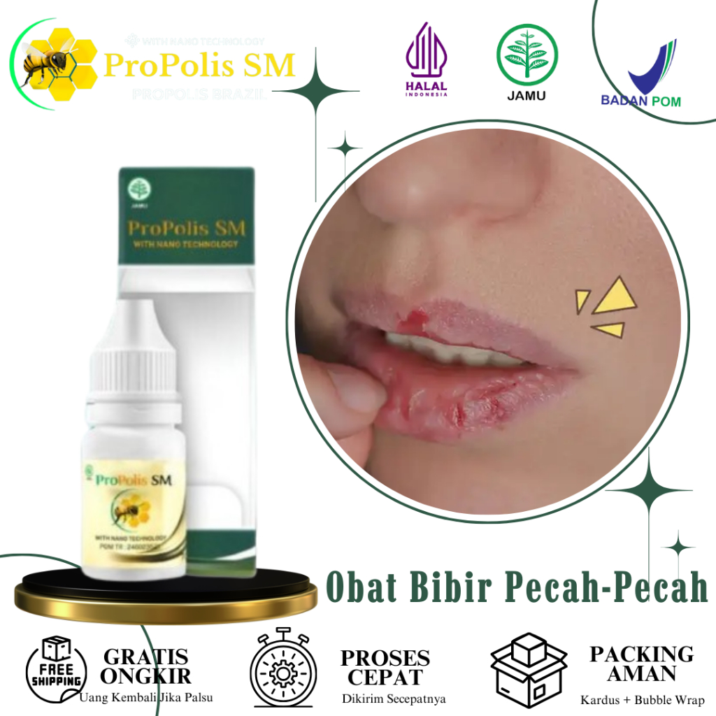 ProPolis SM - Obat Tetes Bibir Pecah-Pecah, Obat Bibir Kering, Obat Bibir Kering Pecah Berdarah, Oba