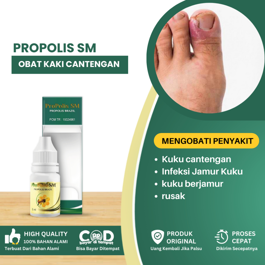 Obat Cantengan, Obat Kuku Rusak, Infeksi Jamur Kuku, Obat Kuku Berjamur, Cairan Obat Cantengan, Obat