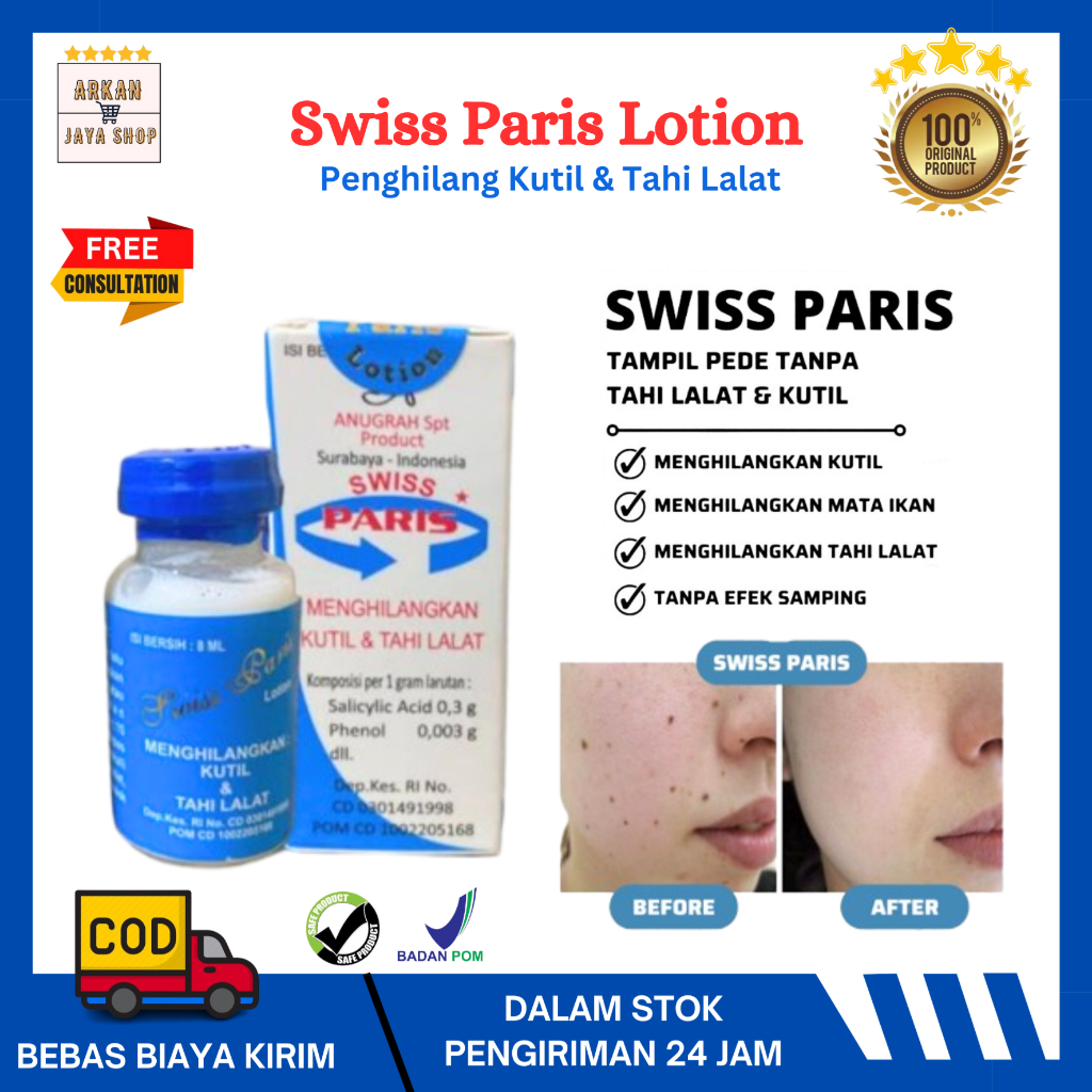Obat Penghilang Tahi Lalat Dan Kutil Di Wajah Swiss Paris Lotion Original Ampuh Salep Cream Pengilan