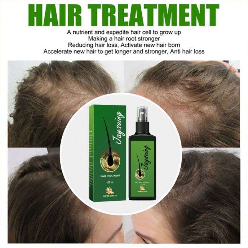 JAYSUING Serum Penumbuh Rambut Hair Growth Spray Obat Penumbuh Rambut Penumbuh Rambut Botak Serum Ha
