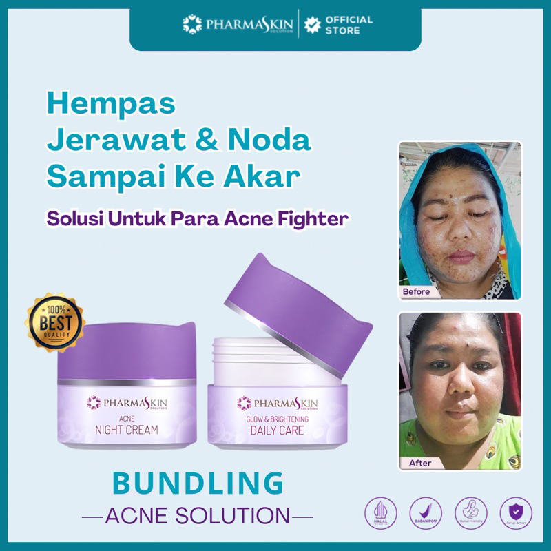 Pharmaskin Paket Bundling Acne Solution Paket Acne Glowing Skincare | Obat Jerawat | Salep Jerawat