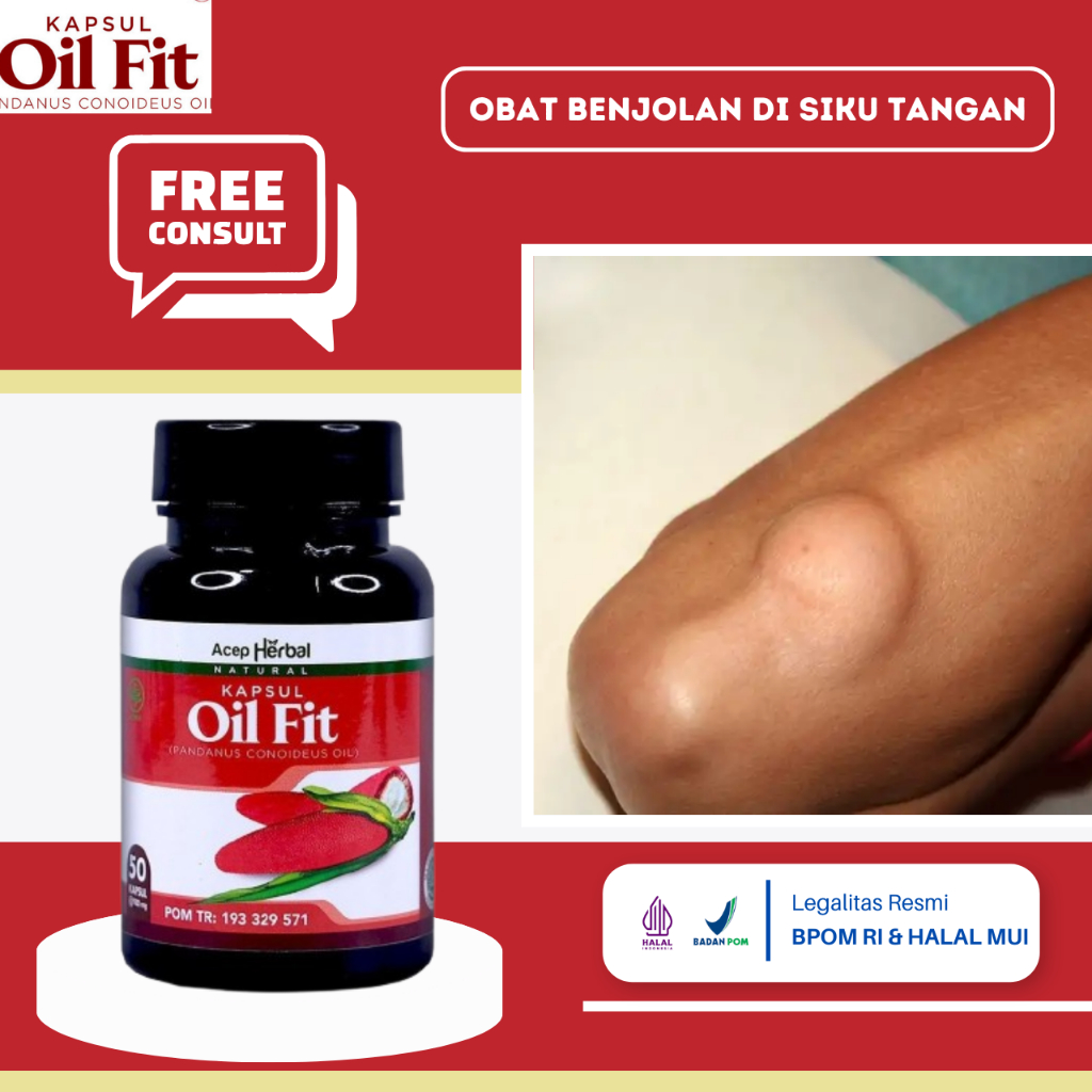 Obat Benjolan Di Siku Tangan, Obat Benjolan Di Tangan, Obat Menghilangkan Benjolan Lipoma, Obat Benj