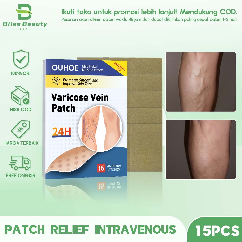 OUHOE Varicose Vein Patch Obat Varises Koyo Varises Obat penghilang Varises Patch 15pcs