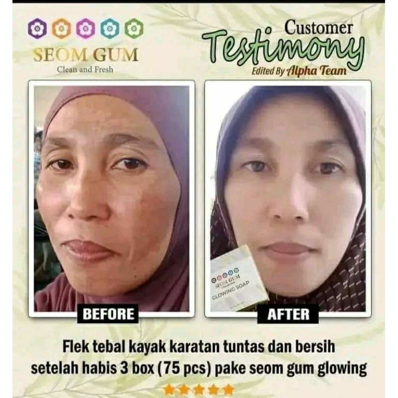 SABUN SEOM GUM KUNING