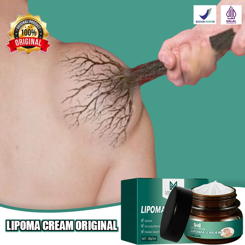 Lipoma cream original Obat benjolan Lipoma removal cream original Obat lipoma Salep lipoma salep ben