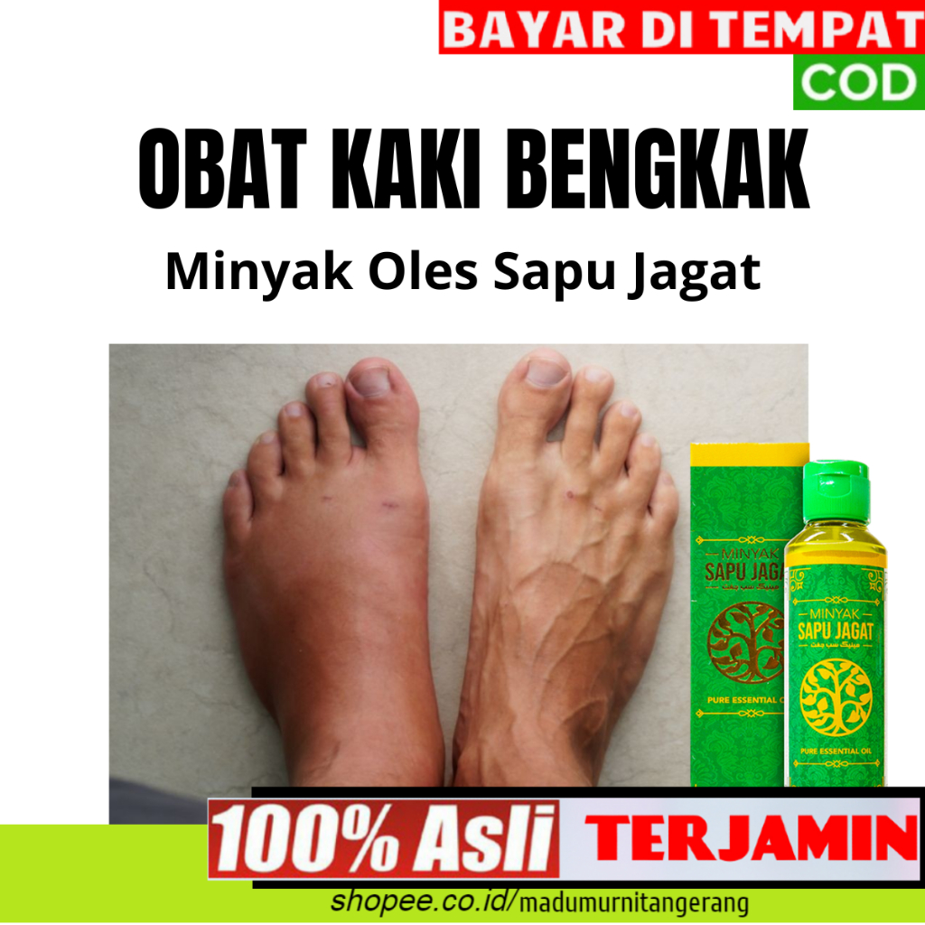 Obat Bengkak Pada Kaki Minyak Pijat Urut Sapu Jagat Dapat Membantu Penyembuhan Sakit Pada Kaki Seper