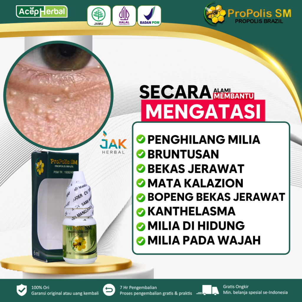 Propolis SM - Obat Penghilang Milia diwajah, Obat Milia di bawah Mata, Obat Milia di area mata, Obat