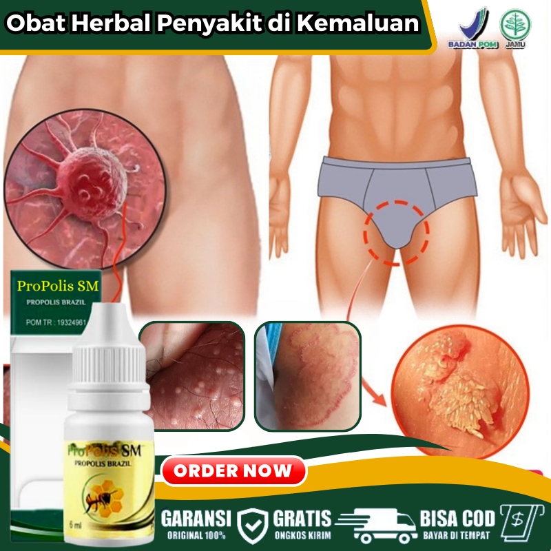 Obat Benjolan di Penis, Bruntusan di Penis, Gatal Ruam Merah di Kemaluan Pria, Obat Herbal Untuk Her