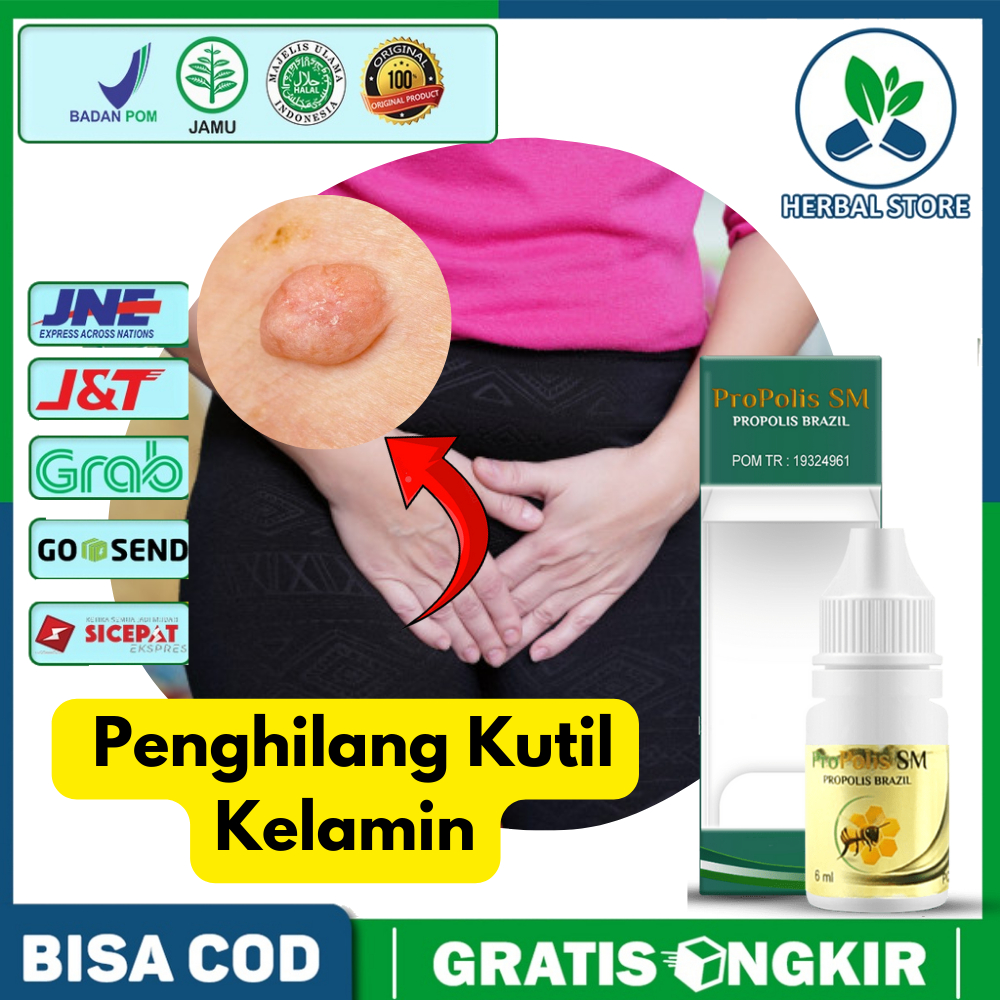 Obat Kutil Kelamin Pria & Wanita  Perontok Kutil Kelamin  PROPOLIS SM 100% ASLI Sudah BPOM