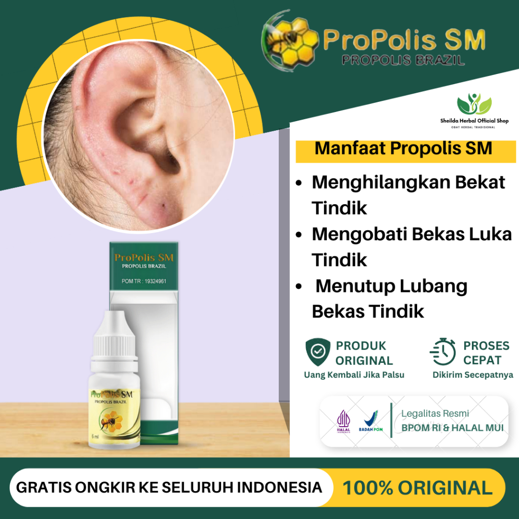 obat keloid, penghilang keloid, obat keloid di telinga, penghilang bekas keloid di telinga, benjolan