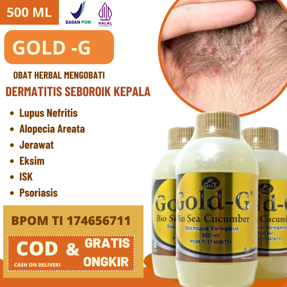 Obat Dermatitis Seboroik Kepala, Kulit Kepala Memerah, Ruam, Gatal, dan Bercak Bersisik Herbal Ampuh