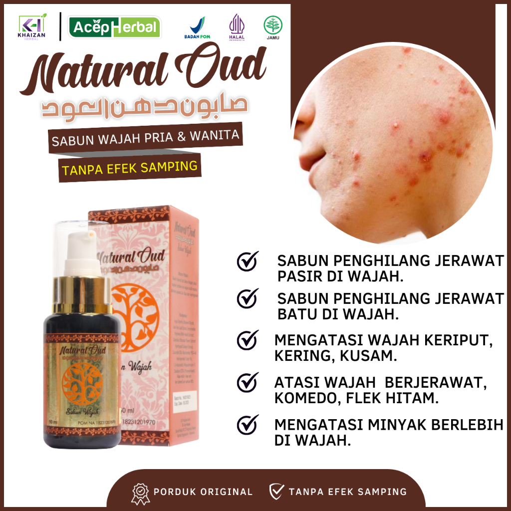 Natural Oud Facial Wash Sabun Herbal Penghilang Jerawat Pasir, Jerawat Batu, Komedo di Hidung, Bopen