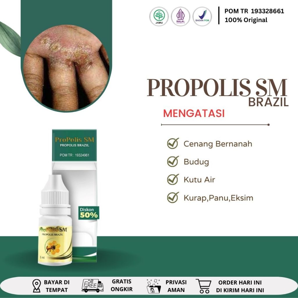 Obat Cenang Bernanah Obat Gatal Berair Obat Kutu Air Obat Budug Obat Borok Obat Gudik Obat Luka Bern