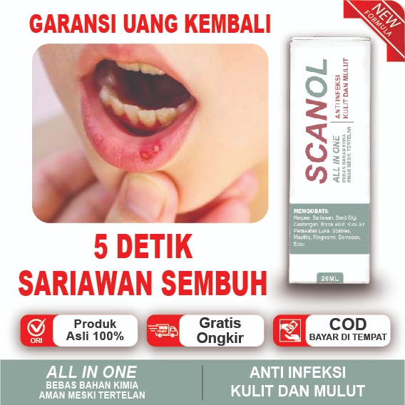 Obat Tetes Sariawan Mulut, Sariawan Lidah, Sariawan Bibir, Sariawan Tenggorokan, Aman Meski Tertelan